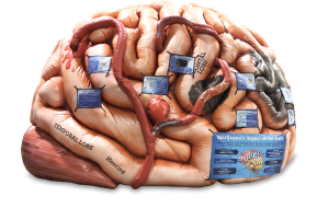 MedicalInflatables-Brain 1